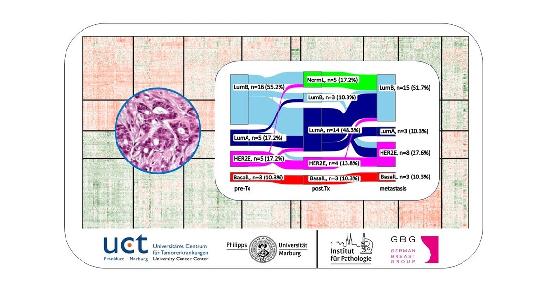 Collage mit Tumorproben, Tumorgeweben und einer Grafik mit Tumor-Subtypen