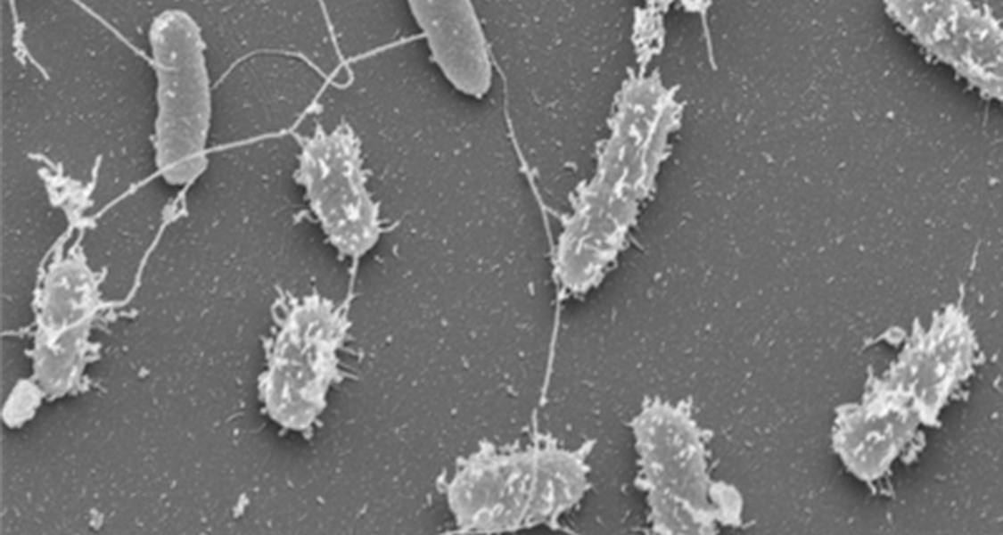 Elektronenmikroskopische Aufnahmen von Typ 1 Pili bei Salmonella Typhimurium.  Dabei stellen die kurzen Ausstülpungen der bakteriellen Zellwand Typ 1 Pili dar und bei den langen filamentösen Strukturen handelt es sich um Flagellen.