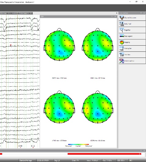 EEG Lab - Labs - Psychology - Philipps-Universität Marburg