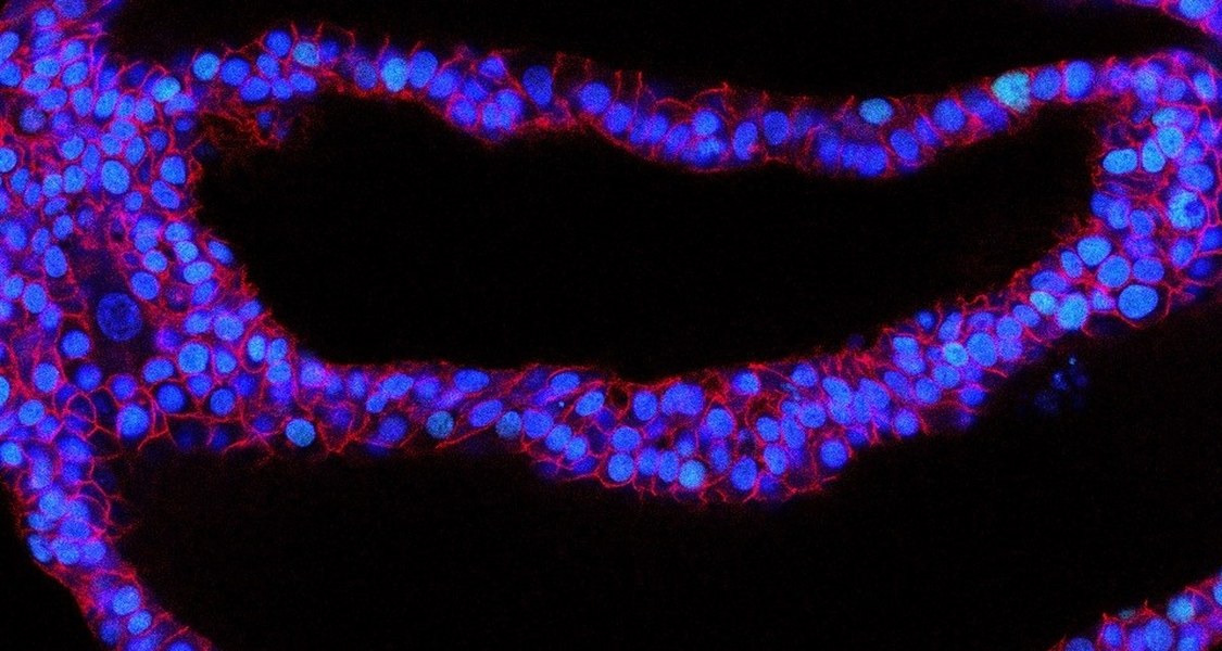 laboratory-grown version of human lungs, known as lung organoid